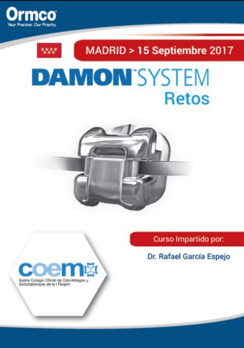 Damon System: Retos -MADRID-
