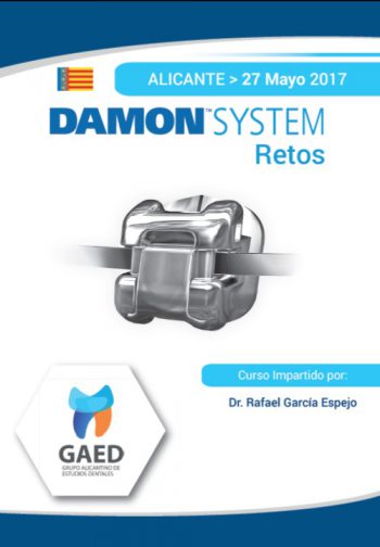 Curso Damon System: retos -Alicante-