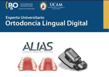 Experto Universitario en Ortodoncia Lingual Digital