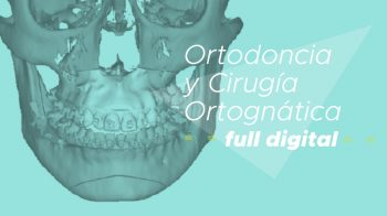 Ortodoncia y Cirugía Ortognática – full digital